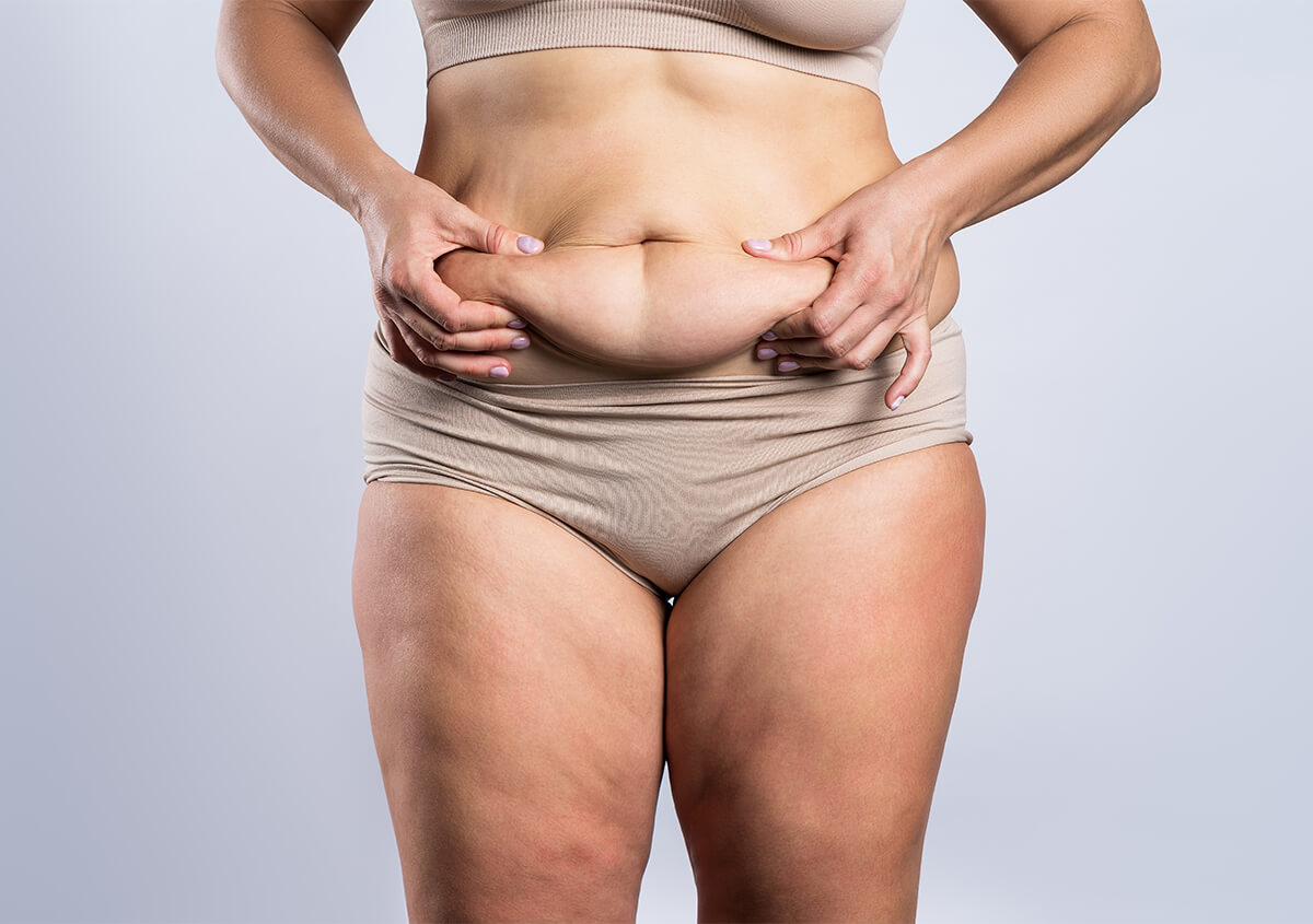 Benefits and Cost of Tummy Tuck in Fountain Valley CA Area