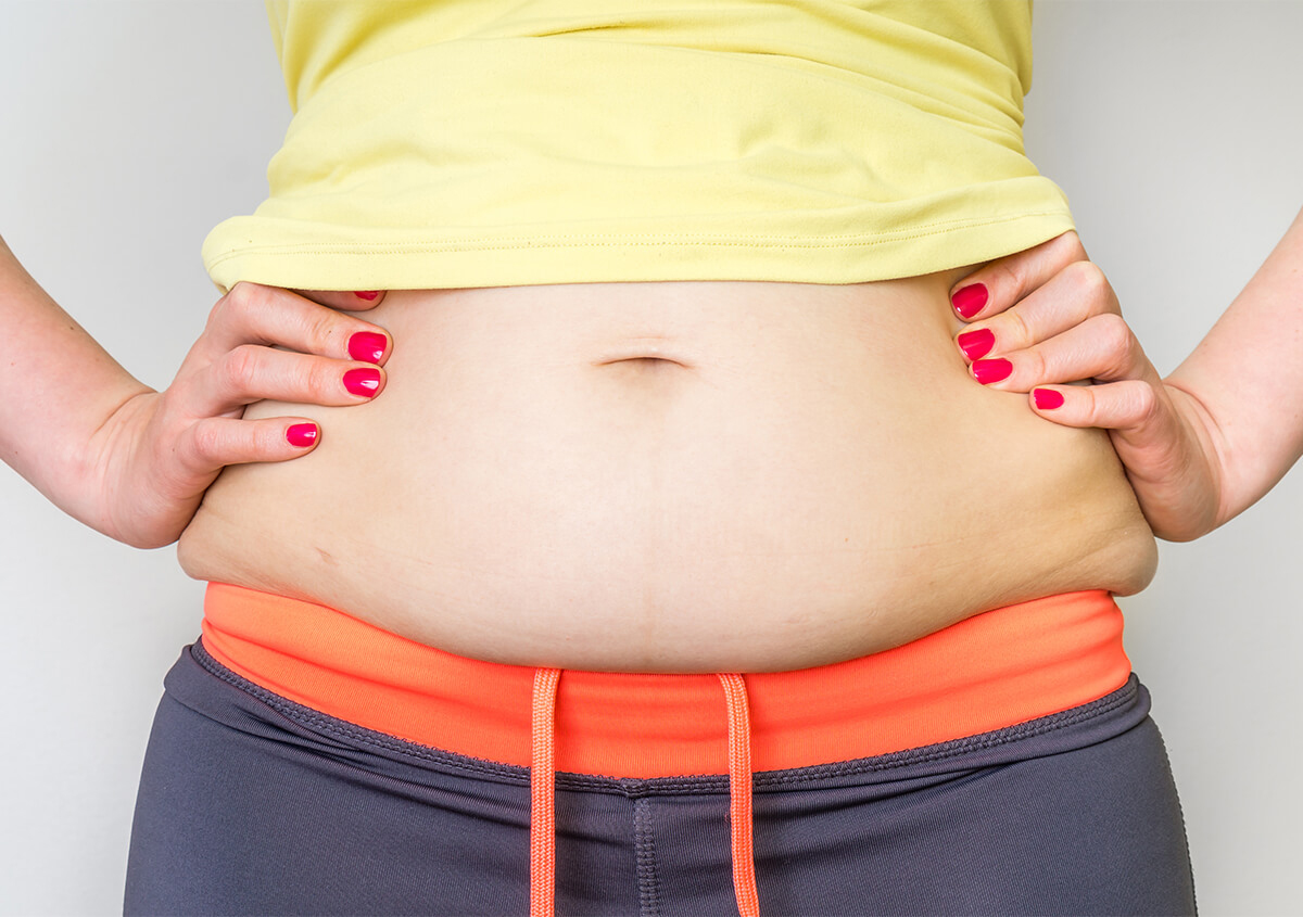 Tummy Tuck Cost in Orange County CA Area