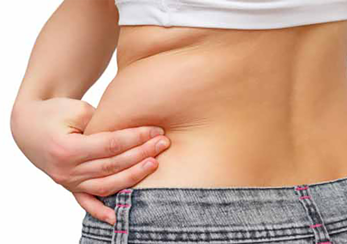 Tummy Tuck Treatment in Fountain Valley CA Area