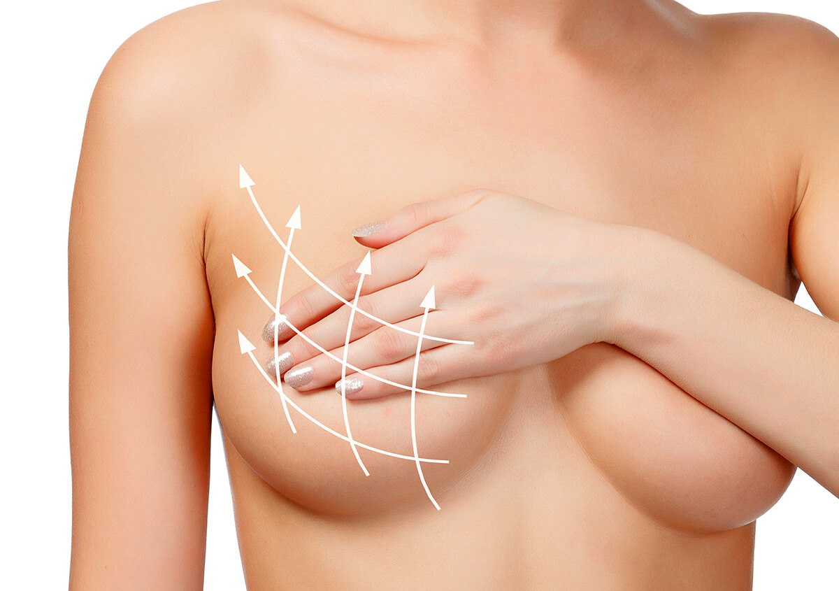 Breast Augmentation Surgery at The Institute of Cosmetic & Reconstructive Surgery in Los Angeles Area
