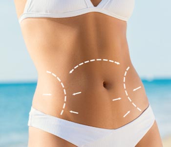 Is there only one type of tummy tuck in Huntington Beach area